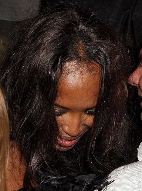 naomi campbell bald head. Bald patch!